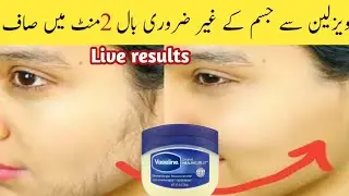 Without threadingI am surprise 👉how Aunty's beard & mustache removed | facial hair removal at home