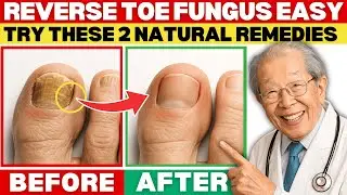 Japan's Oldest Doctor: Cure Toenail Fungus at home &mdash; 2 Natural Remedies Doctors Don&rsquo;t Tell You