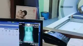 Cect Chest With Abdomen Oral contrast 2022