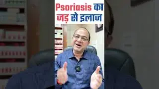 Psoriasis का जड़ से इलाज। Cure Psoriasis With Homeopathy | Best Treatment of Psoriasis