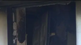 1 hospitalized after fire at Blind Pass condos