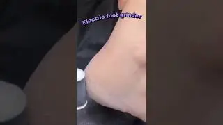 Usb charging foot grinder: eco-friendly convenience