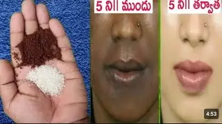 Nose cleaning | Dark spots remove | esy | at home | work | clean and white 🤍| 