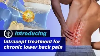 Introducing Intracept Treatment | Pain Treatment Specialists