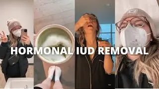 Getting My Hormonal IUD Removed + How I Prepared for it (Positive Experience!)