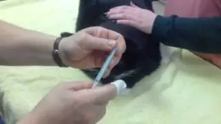 Applying Tramadol gel