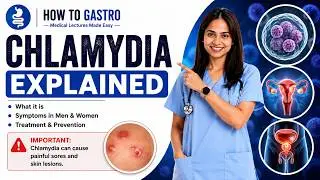 CHLAMYDIA: The #1 Silent STD You Could Have Right Now 😱 | Symptoms, Treatment & Prevention