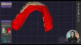 Mastering exocad 01 Fundamentals   Institute of Digital Dentistry