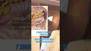 7 sinais de c&acirc;ncer de p&acirc;ncreas! V&iacute;deo completo no canal &ldquo;Mundo da Oncologia&rdquo;