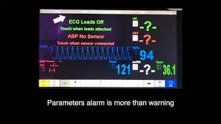 Introduction of monitor&rsquo;s audible cues in healthcare simulation