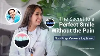 The Truth About Non-Prep Veneers: A Painless Way to Transform Your Smile