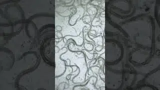 Hot sauce vs. human parasites