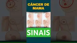 TUMOR DE MAMA: ENTENDO OS SINAIS DO C&Acirc;NCER