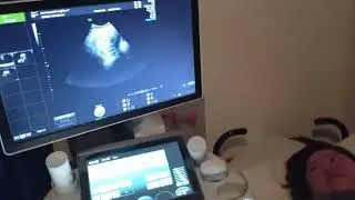 3d ultrasound #babyboy #baby #bebu #3d #pregnancy #newborn #babyboy #trending #philiannabee