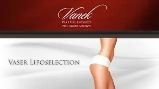 Cleveland Vaser Liposelection