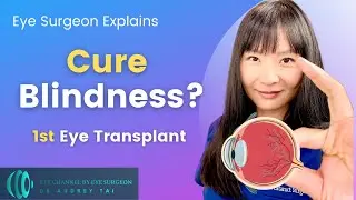 A Cure for Blindness? | World's First Eye Transplant | Eye Surgeon Explains #draudreytai