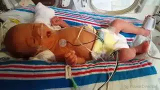 Nicu day 17, Vlog #2