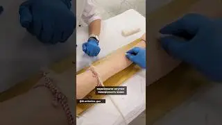 Как поставить капельницу
