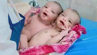 Identical twins double blessing for perents baby fully covered by vernix