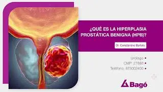 &iquest;QU&Eacute; ES LA HIPERPLASIA PROST&Aacute;TICA BENIGNA (HPB)?