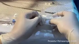 Pemasangan Kontrasepsi Spiral (IUD) - Obgyn Unsri