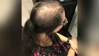The gift of new hair