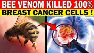 How Bee Venom Wiped Out 100% of Aggressive Breast Cancer Cells In Just 6 Hours