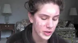 Foundation Routine Flawless Skin Full Coverage Tutorial) Cystic Acne   Scaring Diamondsandheels14  Y