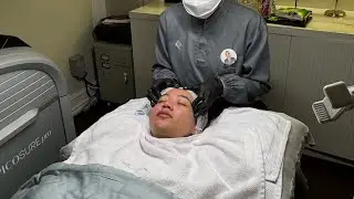 lika liku treatment scars - trifill pro at airin skin clinic
