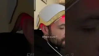 Casque LED pour la repousse des cheveux : r&eacute;volution ou illusion ?
