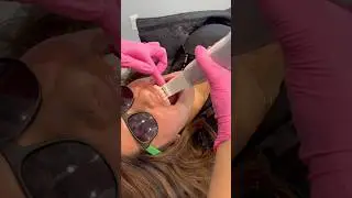Behind the Scenes of Starting Invisalign: What REALLY Happens 🦷 #ASMR