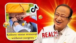 KIDNEY STONE REMOVED FROM SKIN IN INDIA?! | TIKTOK REACTION VIDEO