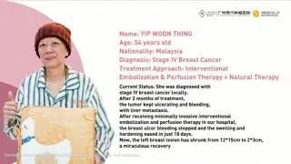 Persistent Breast Tumor Ulceration and Bleeding: Hemostasis and Tumor Reduction Achieved in 18 Days
