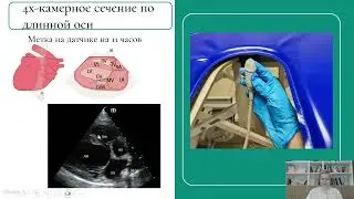 ВНУТРИ КУРСА | Проекции УЗИ сердца, ЛГ, патологии, протокол ЭХО у собак и кошек | Онлайн-курс по ЭХО