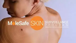 MoleSafe Skin Surveillance Program