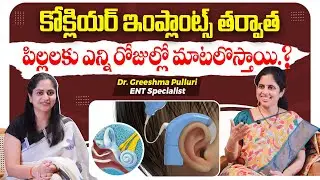 How Many Days After Cochlear Implant Can Children Talk? Explained | Cochlear Implant Recovery