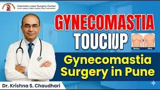 Refine Your Chest: Gynecomastia Touchup Surgery in Pune | Dr. Krishna Chaudhari