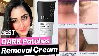 Best tanning Pigmentation Dark Spots Removal Cream | ThriveCo Dark Patches Corrector Review  - Menka