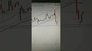 SONATA SOFTWARE |DAY TRADING| INTRADAY TRADING |SWINGTRADING|#shorts #youtubeshorts #shorts
