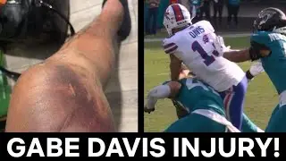 Gabe Davis DONE for Playoffs? Shocking Knee Injury Crushes Bills Hopes!