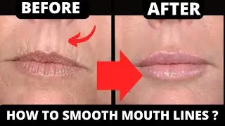 Get Rid of Smoker Lines: Easy Face Yoga Exercises for Smooth Lips!