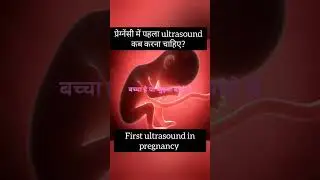When Should You Get Your First Ultrasound?pregnancy ultrasound|early pregnancy|baby development|