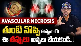 తుంటి మార్పిడి లేట్ చేస్తే ప్రమాదం! | Hip replacement surgery in telugu | AVN hip | Dr Ratnakar Rao
