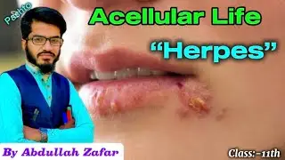 Herpes Virus (Acellular Life) By Abdullah Zafar in Pashto ||  Class-11th biology || Herpes diseases