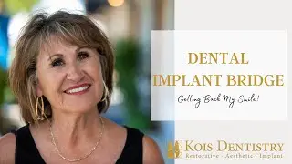 My Smile Is Very Important To Me and Dr. Kois Gave It Back To Me
