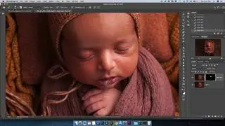 HOW TO CLEAN UP BABY'S RASH SKIN