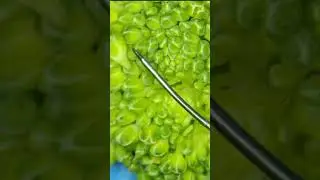 Microsurgery Practice: Suturing Broccoli 🥦 with 10-0 Suture at Home! 🔬🧠 #ophthalmology #surgery