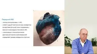 Диагноз ОКС ч 8
