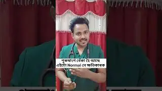 Puruhor lingo beka hole ki problem hoi , #health #drtoufiqurrahman #homeremedies #enhancehealth