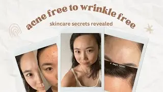 Daily Skincare Routine for Acne + Wrinkle Free Skin | Pure Products & the Skin Protocol I Used
